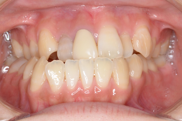 Before image