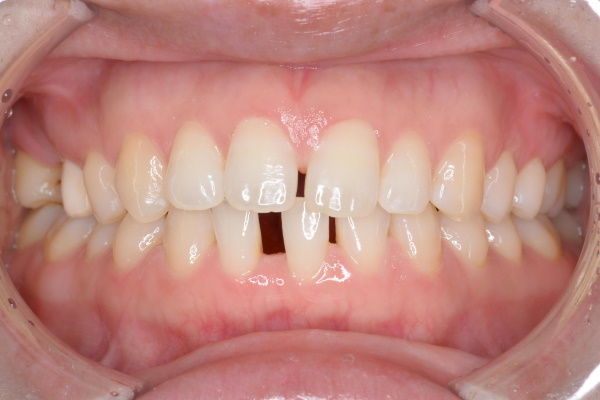 Before image