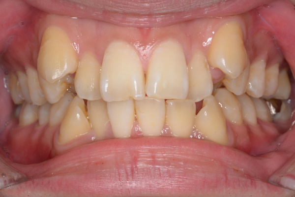 Before image