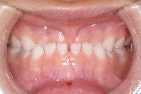 Before image