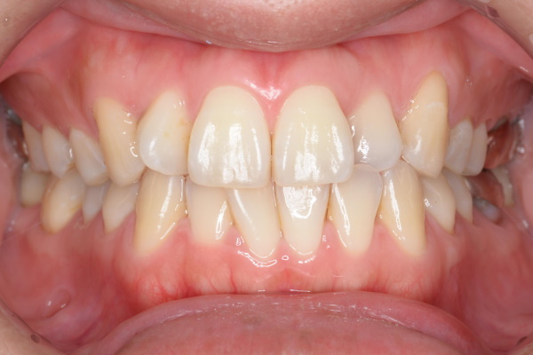 Before image