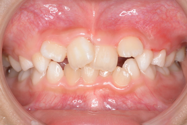 Before image