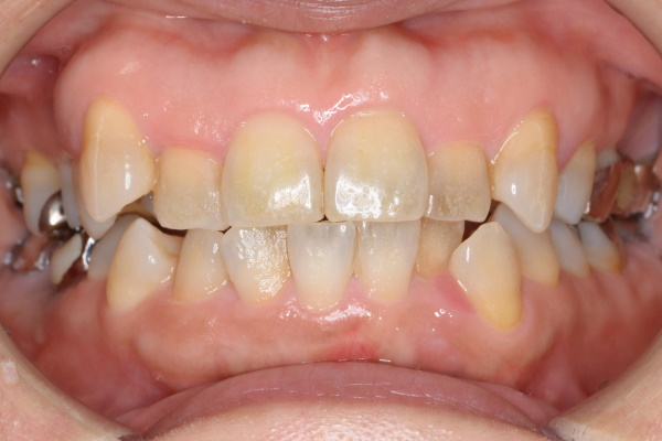 Before image