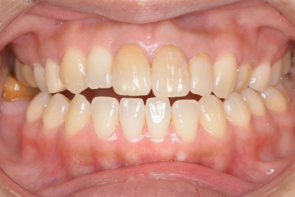 Before image