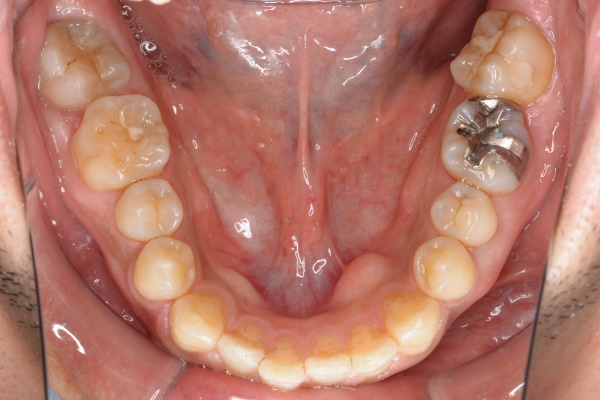 After image