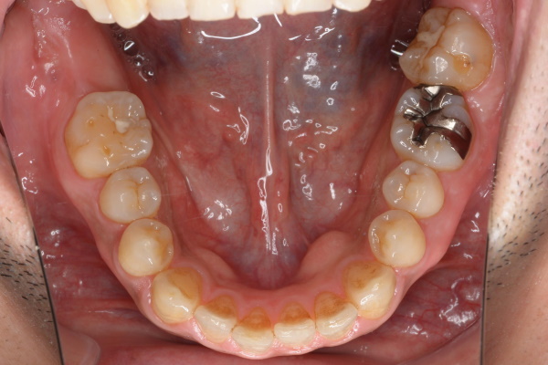 Before image