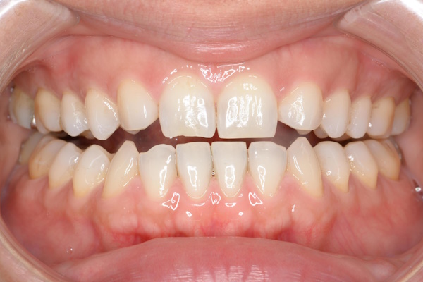 Before image