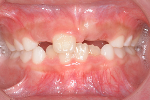 Before image