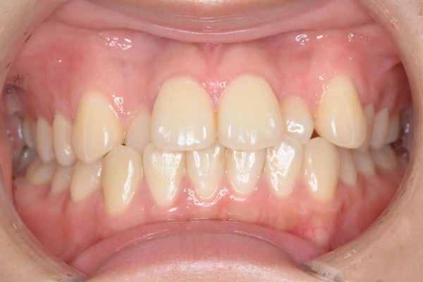 Before image