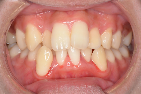 Before image