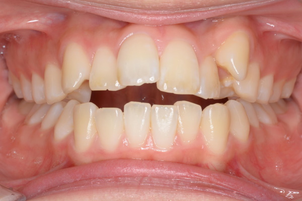 Before image