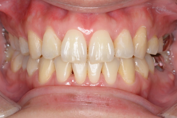 After image