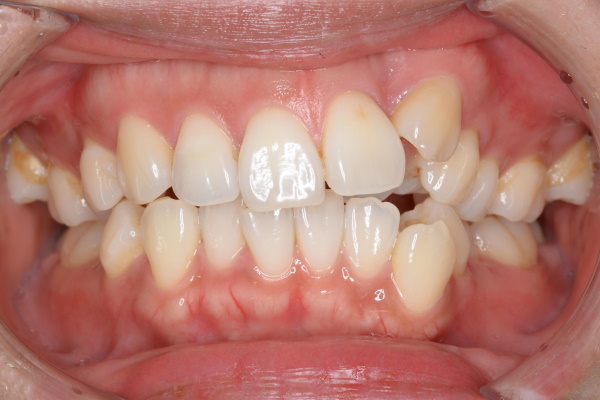 Before image