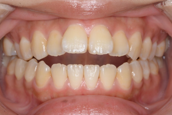 Before image