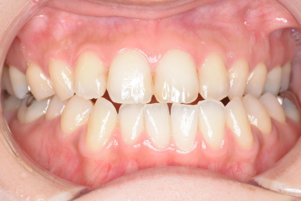 Before image