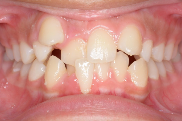 Before image