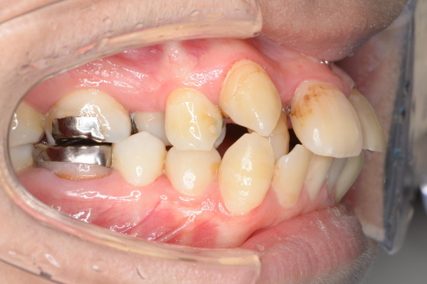 Before image
