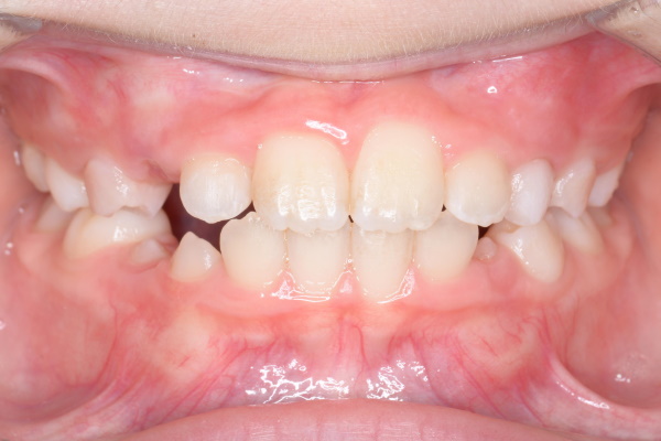 After image
