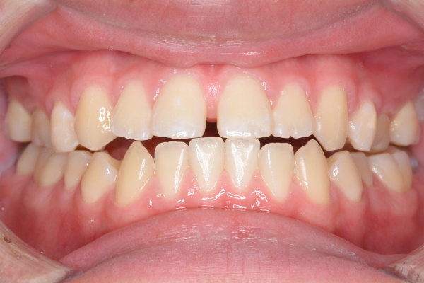 Before image
