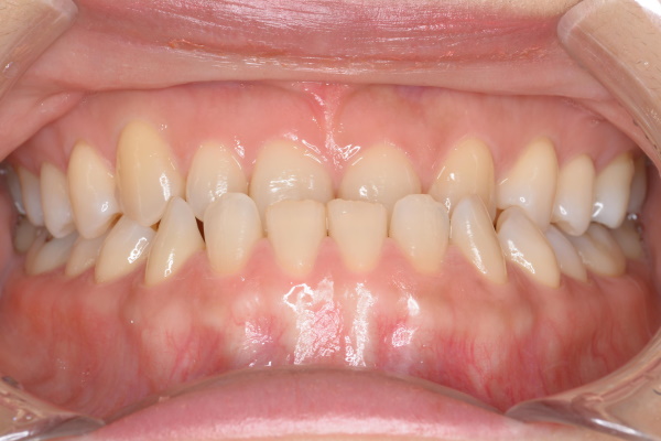 Before image