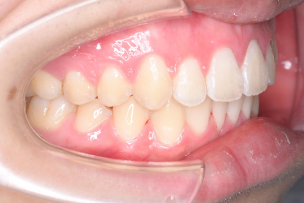 After image