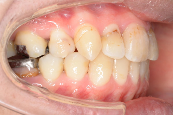 After image