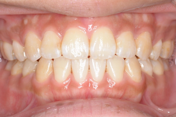 After image