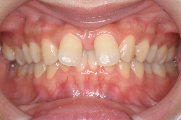 Before image
