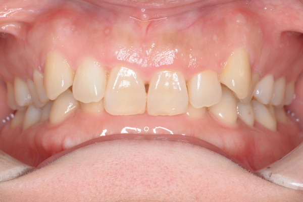 Before image