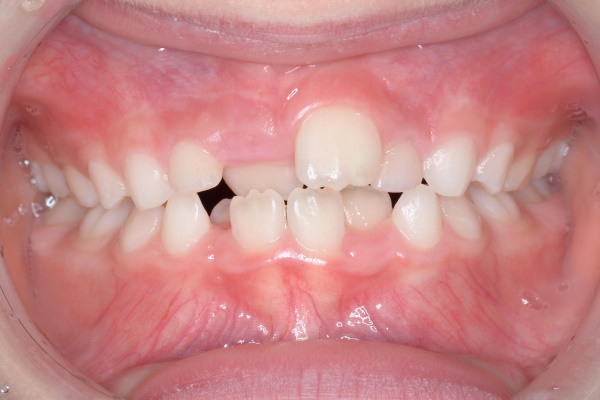 Before image
