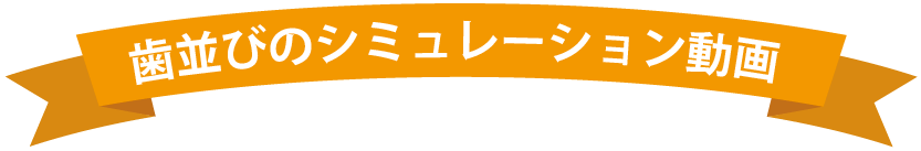 RIBON