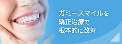 ガミースマイル