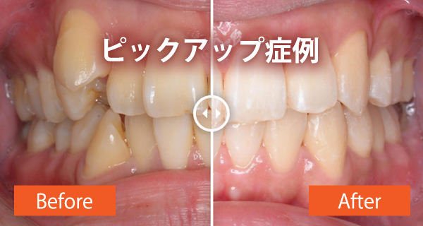 ピックアップ症例